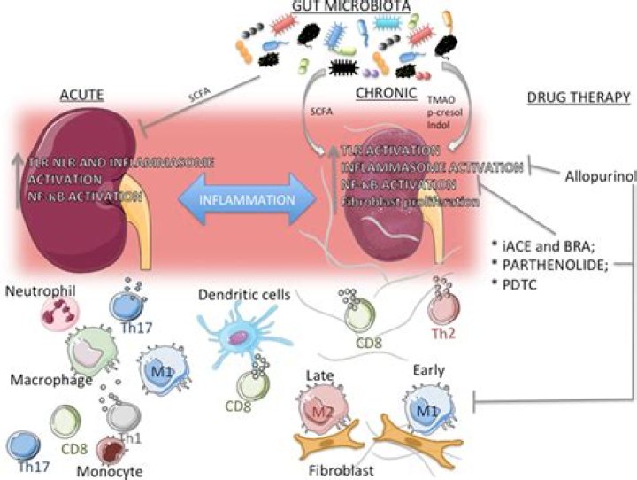 By inflammation of the kidney?