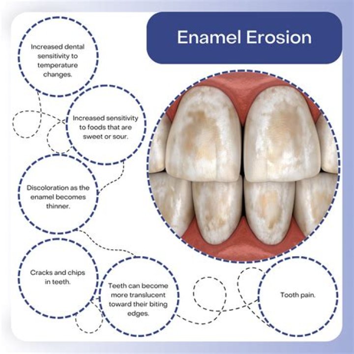 Can baking soda erode tooth enamel?