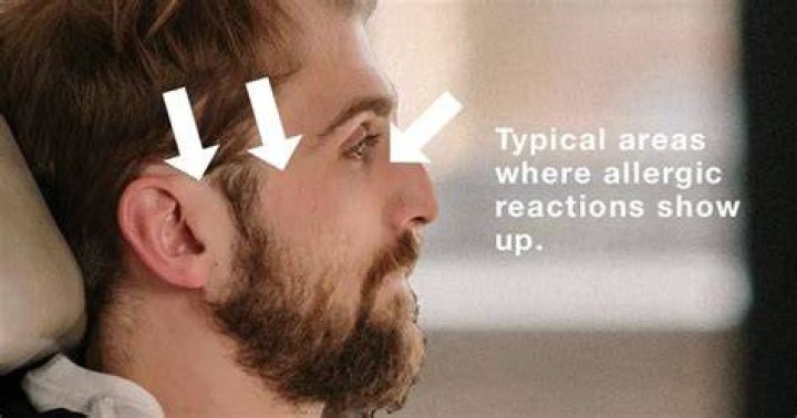 Could i be allergic to my glasses frames?