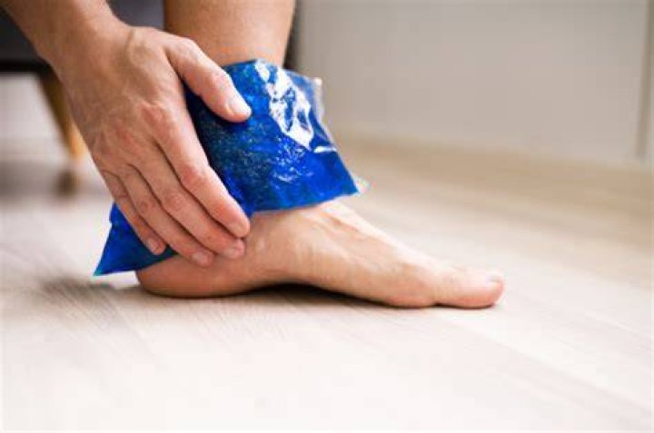 Should you put ice on a sprain?