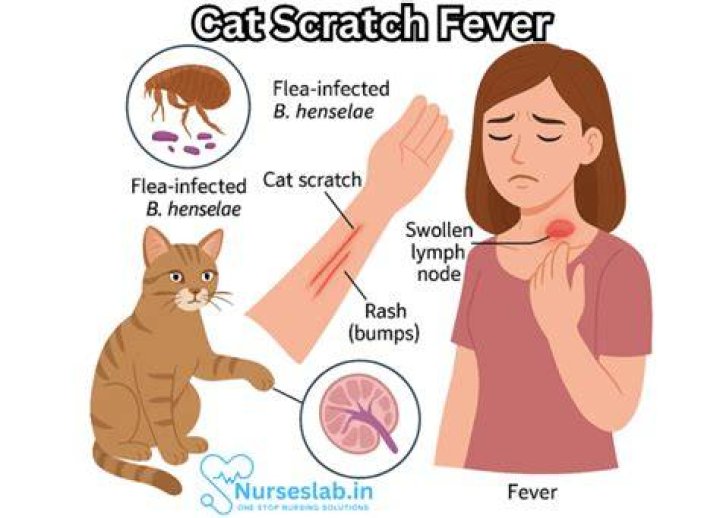 Was cat scratch fever?