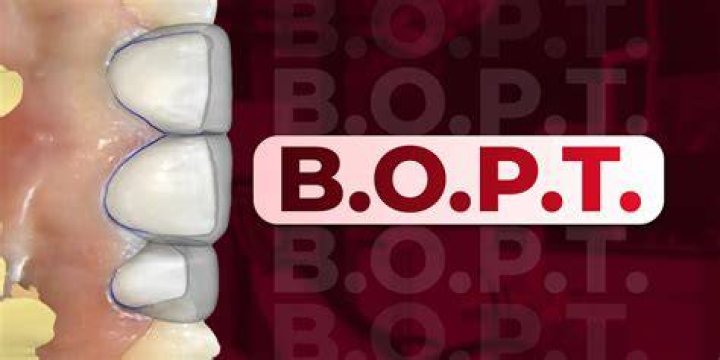 What is b o p?